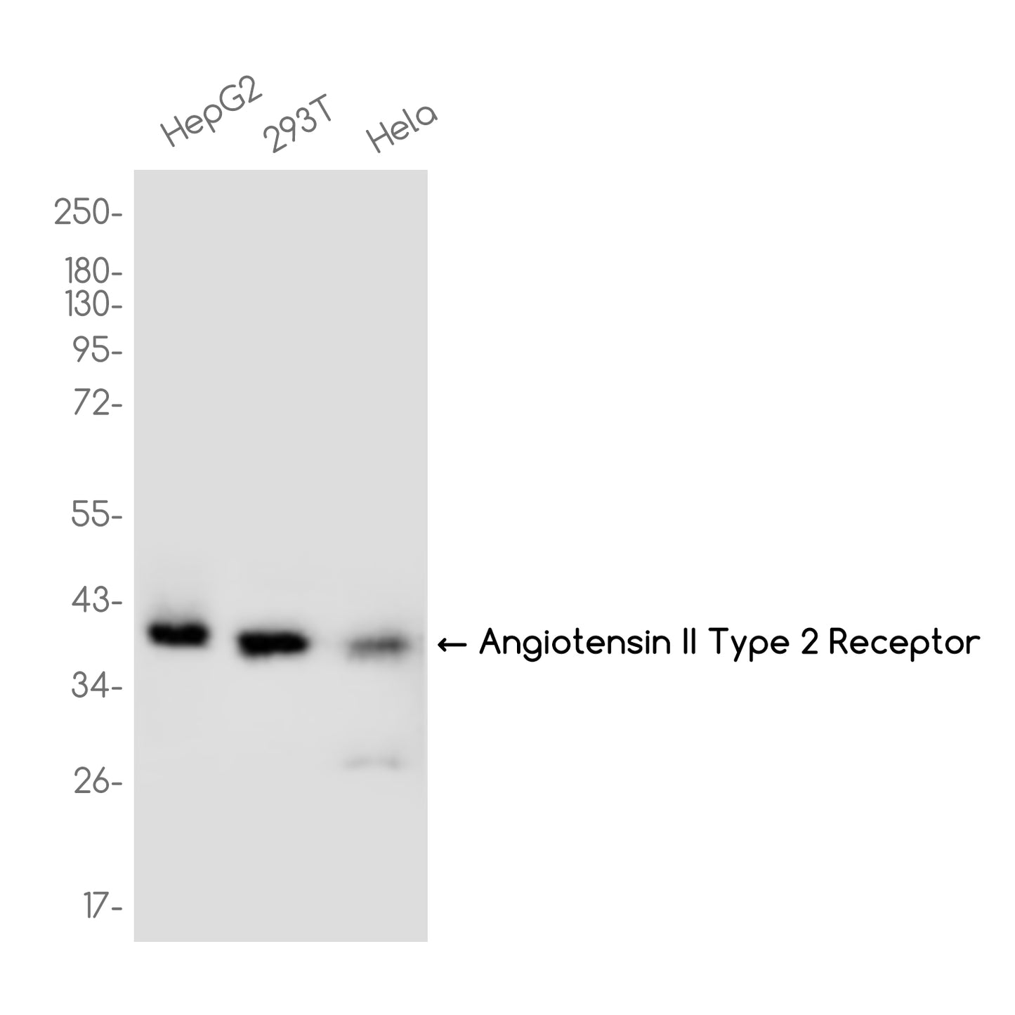 AGTR2 Receptor Rabbit Monoclonal Antibody