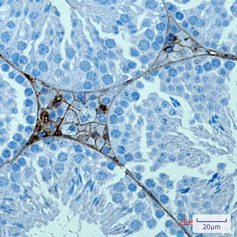 PRAME Rabbit Monoclonal Antibody