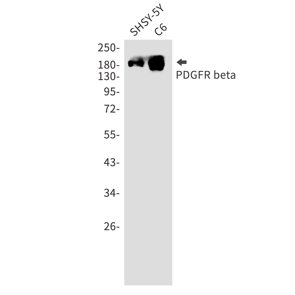 PDGFR beta Rabbit Monoclonal Antibody