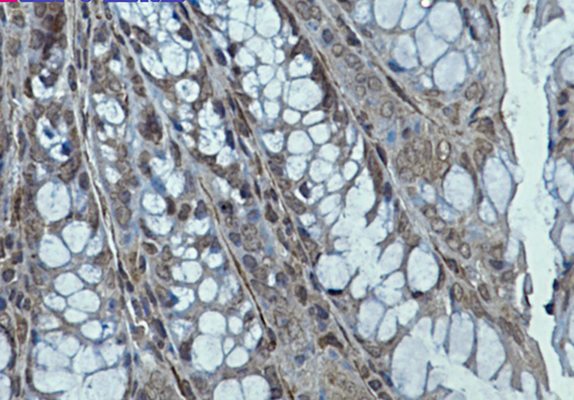 Creatine Kinase B type Rabbit Monoclonal Antibody