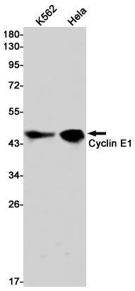 Cyclin E1 Rabbit Monoclonal Antibody