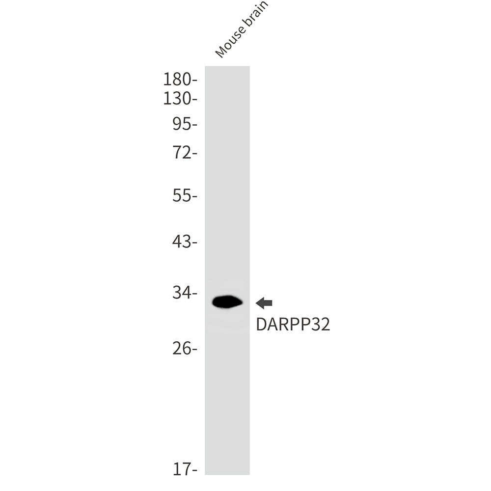 DARPP32 Rabbit Monoclonal Antibody