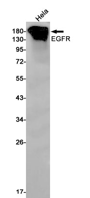 EGFR Rabbit Monoclonal Antibody