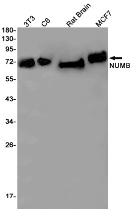 NUMB Rabbit Monoclonal Antibody