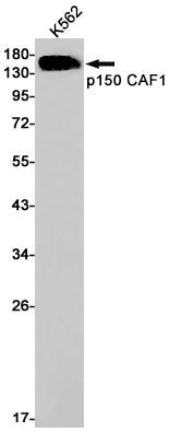 p150 CAF1 Rabbit Monoclonal Antibody