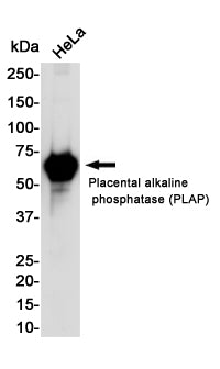Placental Alkaline Phosphatase Rabbit Monoclonal Antibody