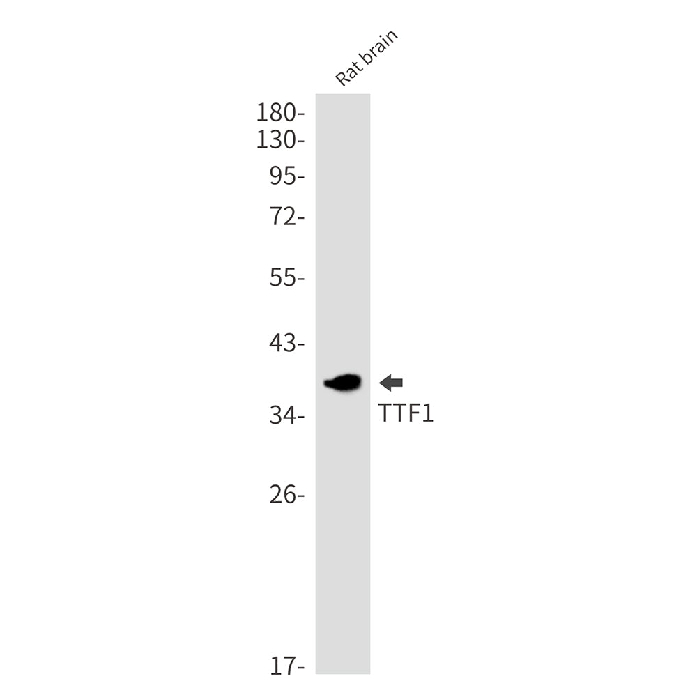 Thyroid Transcription Factor 1 Rabbit Monoclonal Antibody