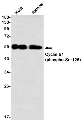 Phospho-Cyclin B1 (Ser126) Rabbit Monoclonal Antibody