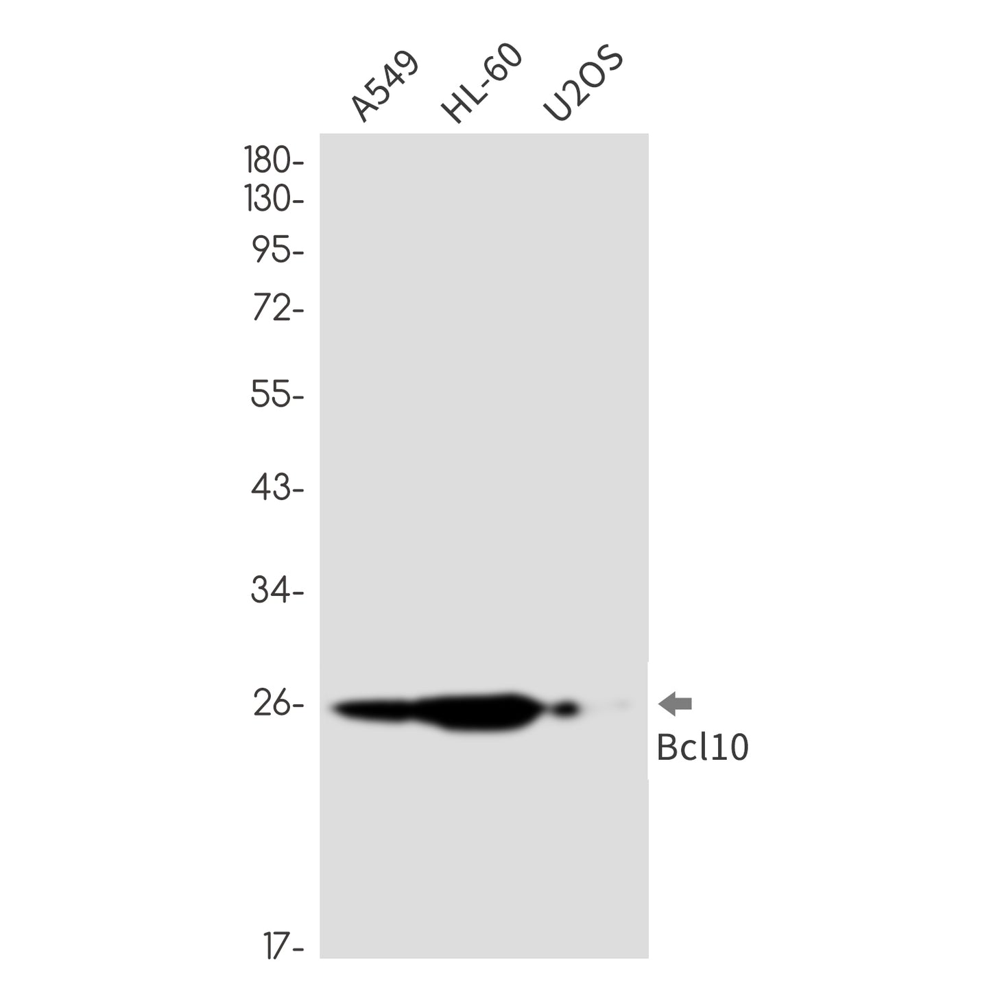 Bcl10 Rabbit Monoclonal Antibody