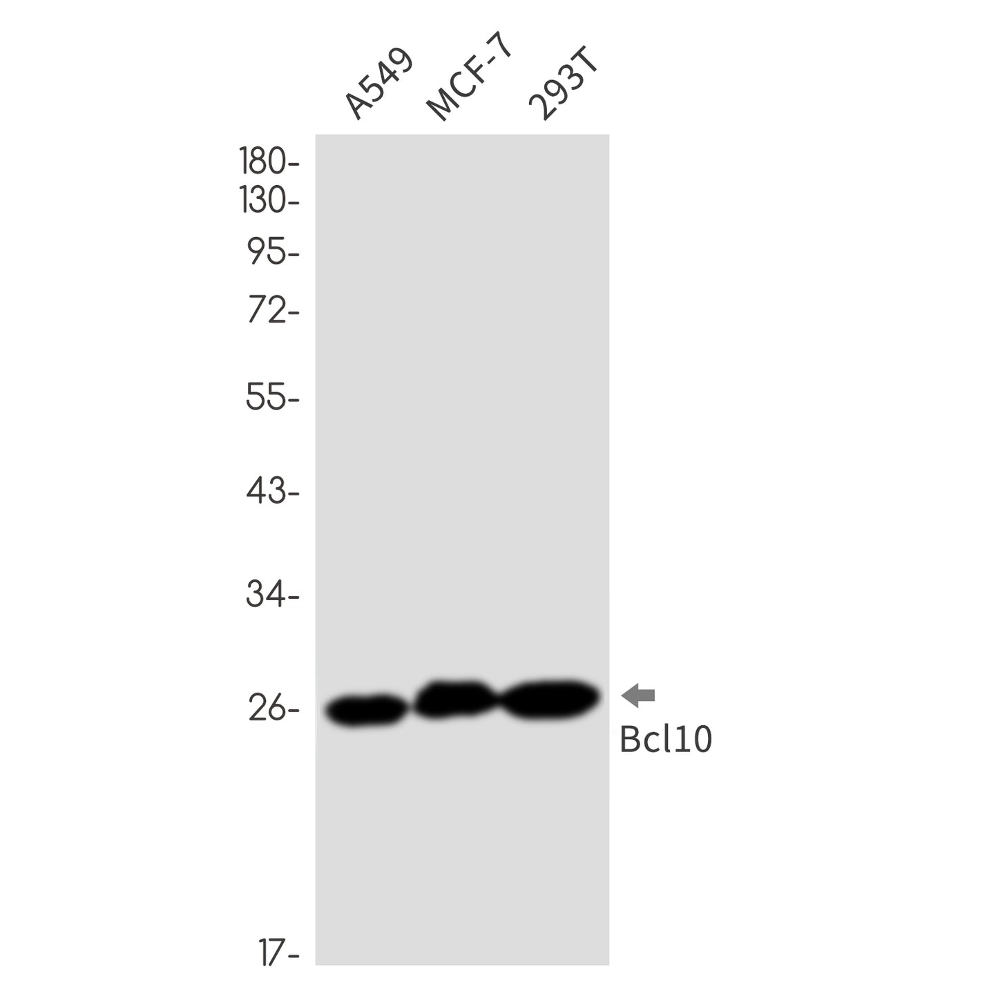 Bcl10 Rabbit Monoclonal Antibody