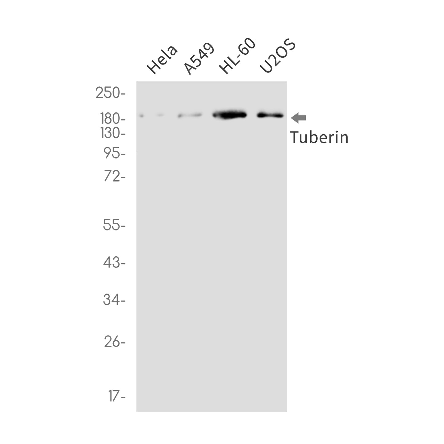 Tuberin Rabbit Monoclonal Antibody