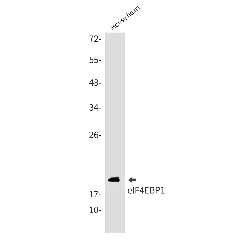 4E BP1 Rabbit Monoclonal Antibody