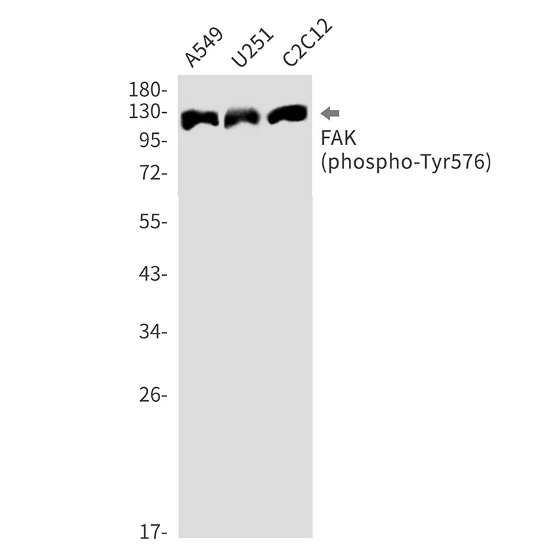 Phospho-FAK (Tyr576) (17X9) Rabbit Monoclonal Antibody