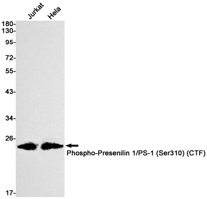Phospho-Presenilin 1 (Ser310) (16E10) Rabbit Monoclonal Antibody