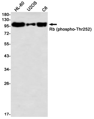 Phospho-Rb (Thr252) (19A8) Rabbit Monoclonal Antibody