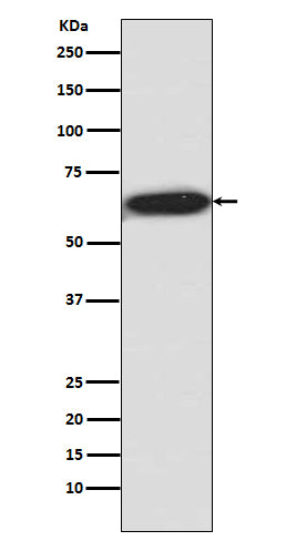 Phospho-S6K1 (T421 + S424)  (1L11) Rabbit Monoclonal Antibody