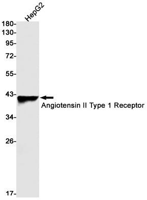 AGTR1  (15Y4) Rabbit Monoclonal Antibody