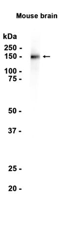 c-Kit  (8Y9) Rabbit Monoclonal Antibody