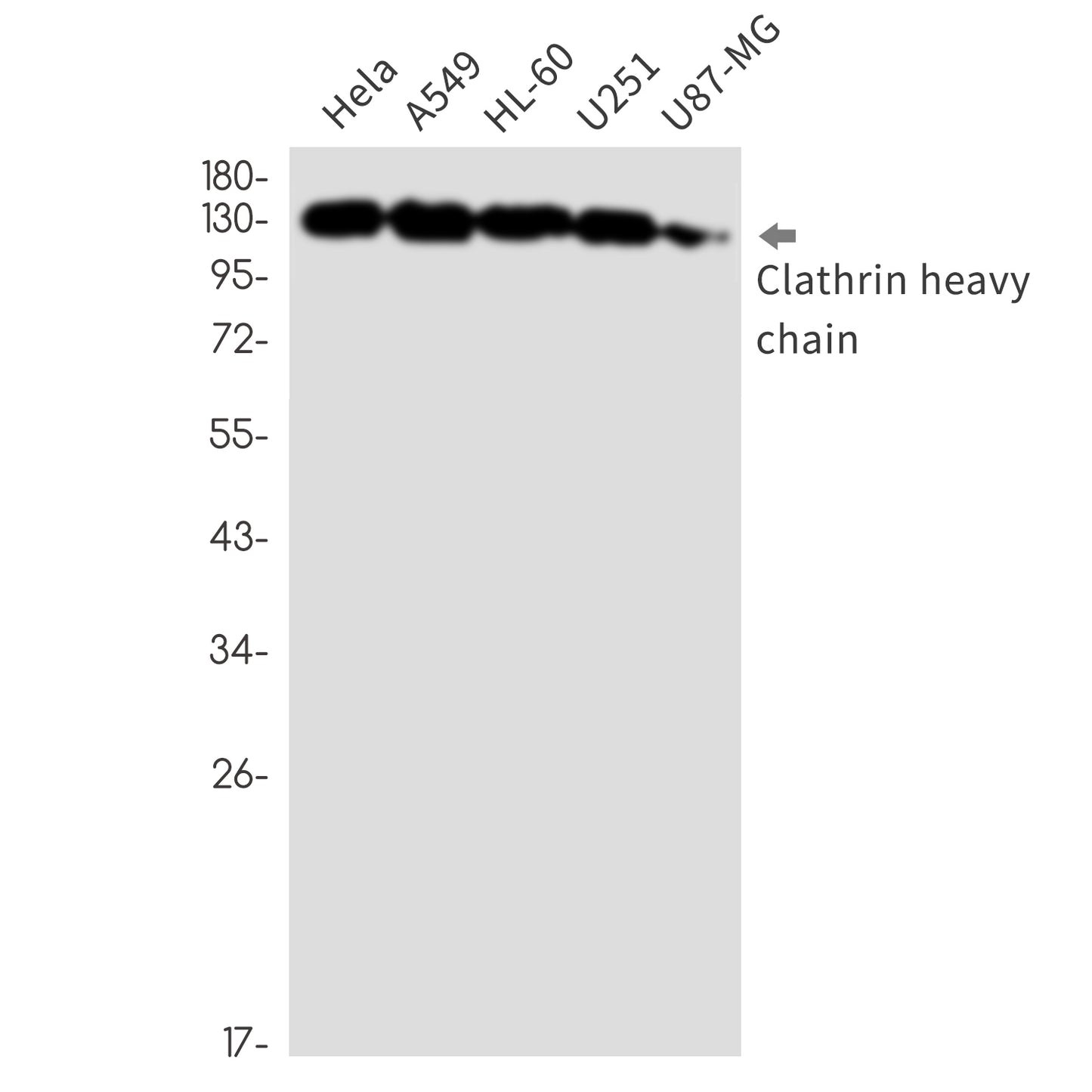 Clathrin heavy chain (18K9) Rabbit Monoclonal Antibody