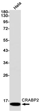 CRABP2 (12M4) Rabbit Monoclonal Antibody