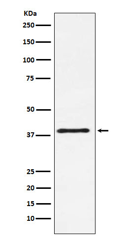 CTLA4 (CD152)  (14H2) Rabbit Monoclonal Antibody
