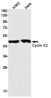 Cyclin E2 (7T5) Rabbit Monoclonal Antibody