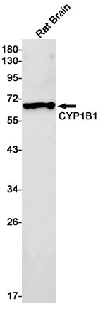 CYP1B1 (17Y5) Rabbit Monoclonal Antibody