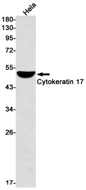 Cytokeratin 17 (9F13) Rabbit Monoclonal Antibody