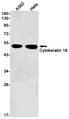 Cytokeratin 18 (6Y2) Rabbit Monoclonal Antibody