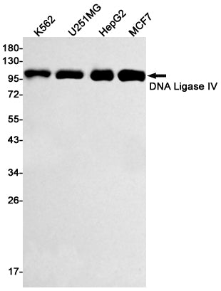 DNA Ligase IV (18K10) Rabbit Monoclonal Antibody
