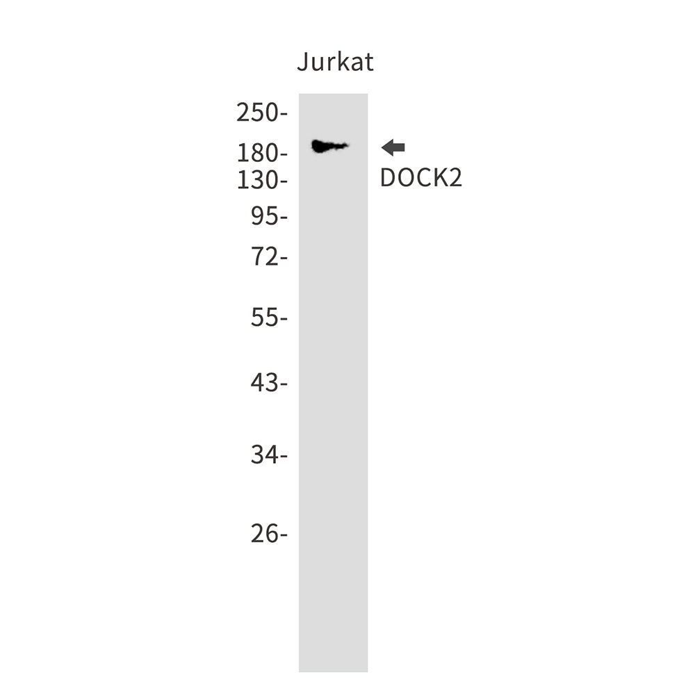 DOCK2 (18N2) Rabbit Monoclonal Antibody
