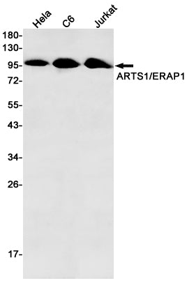 ERAP1 (15I15) Rabbit Monoclonal Antibody