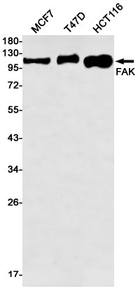 FAK (14V18) Rabbit Monoclonal Antibody