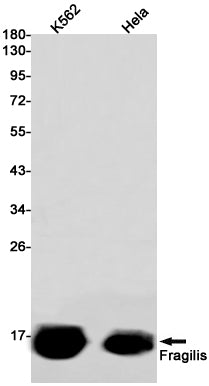 Fragilis (18X2) Rabbit Monoclonal Antibody