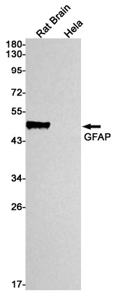 GFAP (2V18) Rabbit Monoclonal Antibody