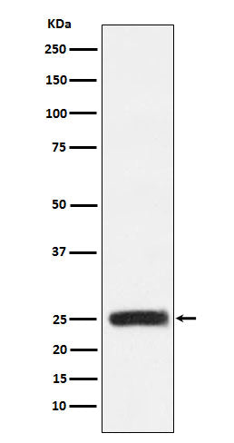 GRB2 (19X8) Rabbit Monoclonal Antibody