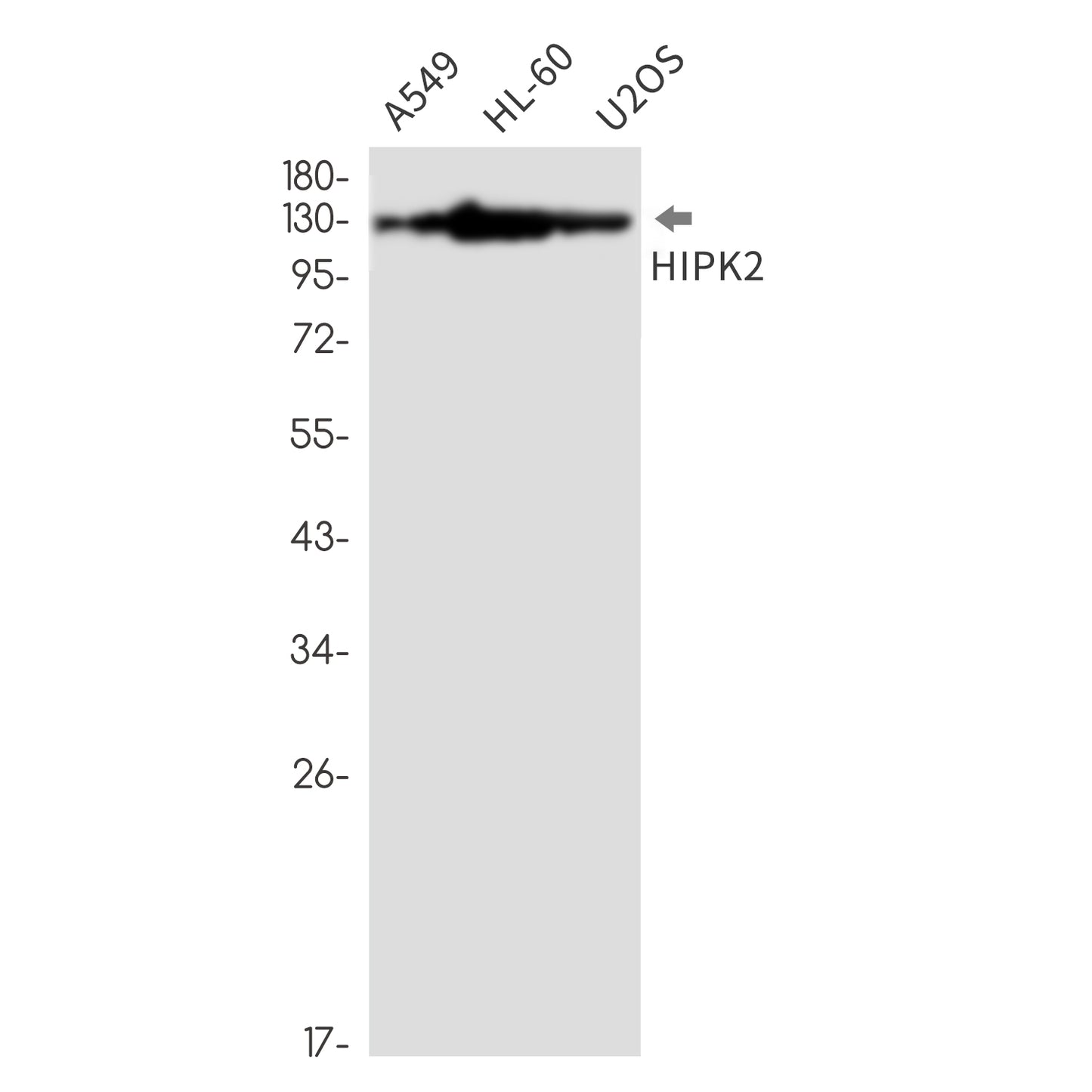 HIPK2 (14G18) Rabbit Monoclonal Antibody