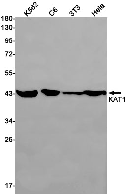 KAT1 (14L6) Rabbit Monoclonal Antibody