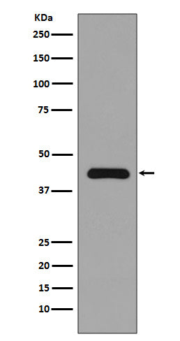 MEK1  (12Q9) Rabbit Monoclonal Antibody