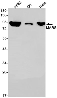 MetRS (12W19) Rabbit Monoclonal Antibody