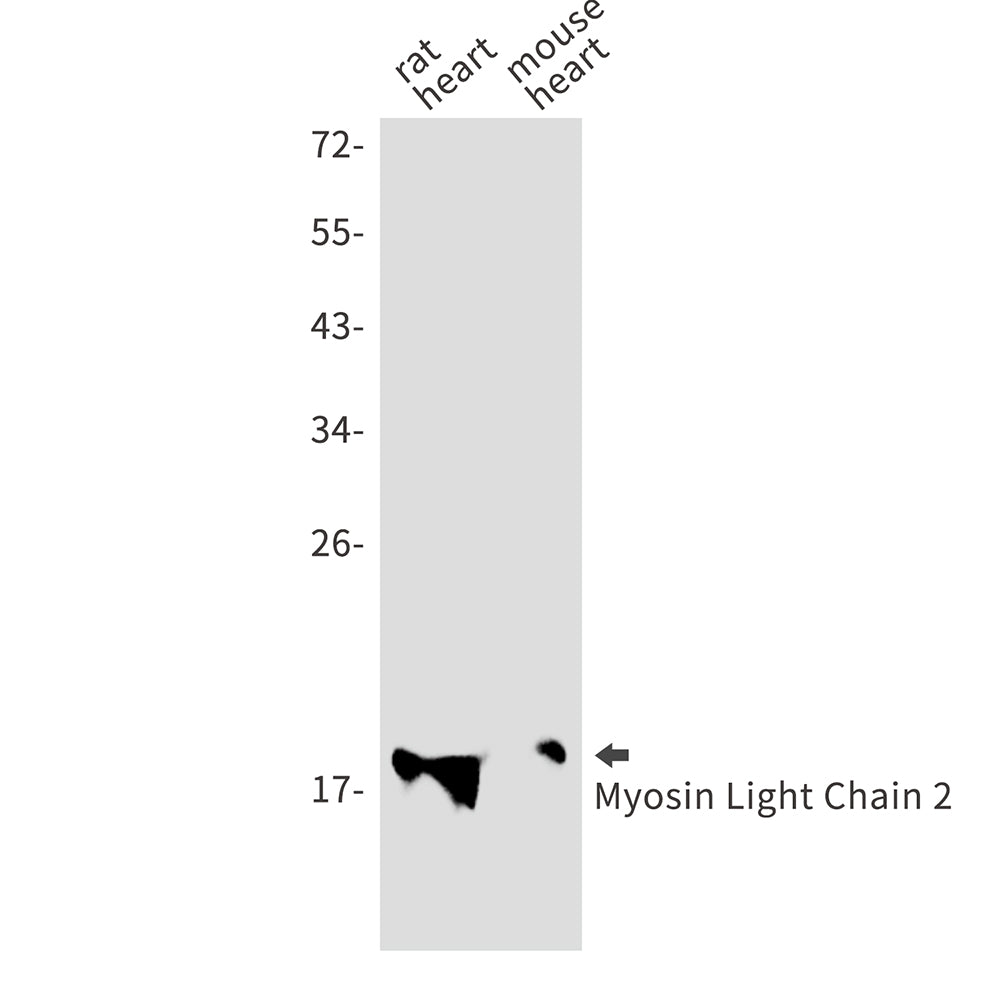 Myosin Light Chain 2 (8D15) Rabbit Monoclonal Antibody