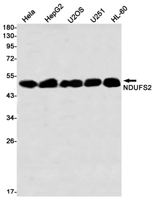 NDUFS2 (1N8) Rabbit Monoclonal Antibody