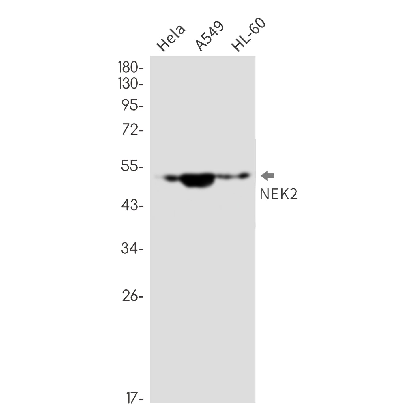 NEK2 (11H12) Rabbit Monoclonal Antibody