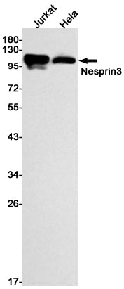 Nesprin3 (5G4) Rabbit Monoclonal Antibody