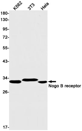 Nogo B Receptor (19G15) Rabbit Monoclonal Antibody