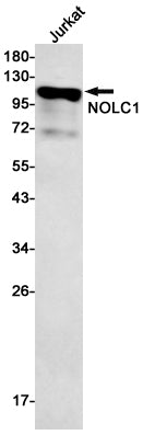 NOLC1 (17R1) Rabbit Monoclonal Antibody