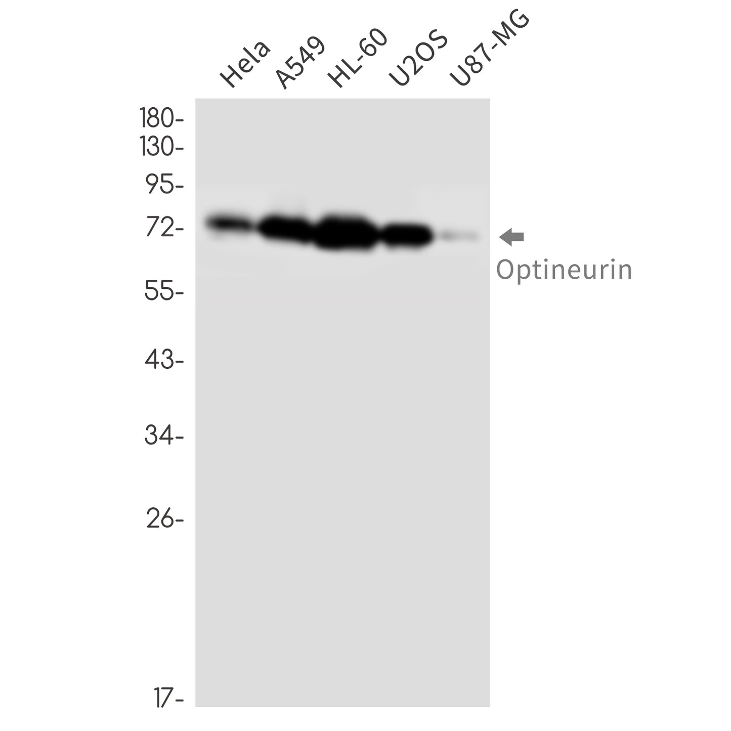 Optineurin (3D13) Rabbit Monoclonal Antibody