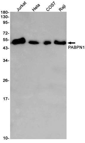 PABPN1 (9U19) Rabbit Monoclonal Antibody