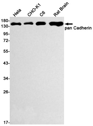 pan Cadherin   (16E7) Rabbit Monoclonal Antibody