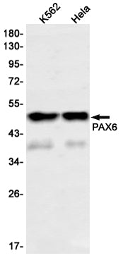 PAX6 (14C4) Rabbit Monoclonal Antibody